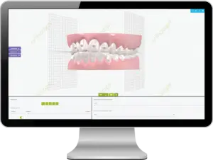 3D Treatment Plan